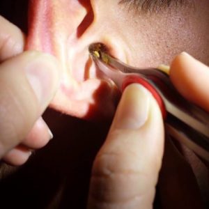 Ear Clean